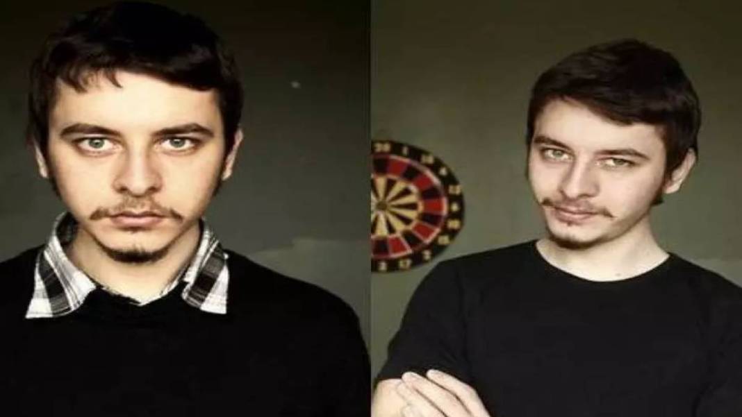 Pis Yedili dizisinin PC'si idi! Herkes onu albino hastası sanıyordu: Gerçek çok farklı çıktı! 4